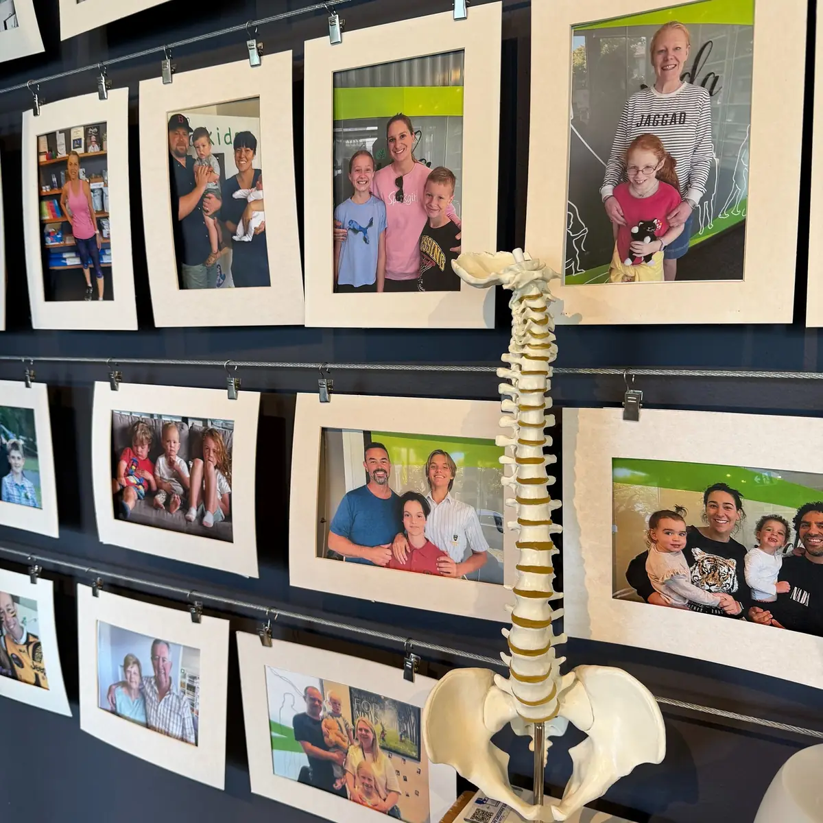 The Vida wall of patient family photos with a model spine